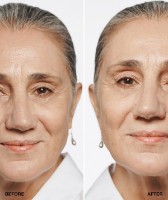 Fond de ten pentru față Clinique Beyond Perfecting Foundation + Concealer CN10 30ml imaginea #2 — magazin online Desire.md