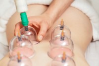 Ventuze pentru masaj vacuum Kangzhu SV6B 6pcs imaginea #2 — magazin online Desire.md