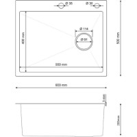 Кухонная мойка SanDonna HD6050 Black фото №3 — интернет-магазин Desire.md