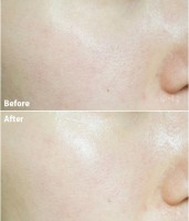 Тонер для лица Dr.Jart+ Ceramidin liquid 150ml фото №3 — интернет-магазин Desire.md